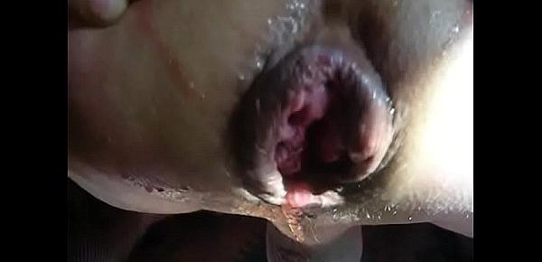  severe mistress  fist sissy slut result hole destruction and prolapse